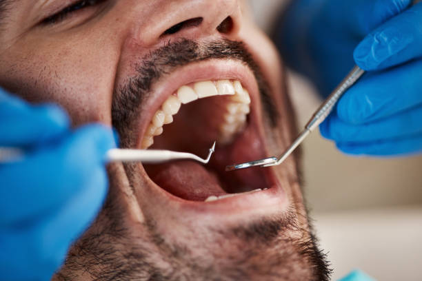 Best Pediatric Emergency Dentist in Landing, NJ